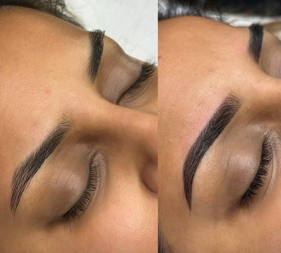 Georgia Taylor Beauty — finished treatment result